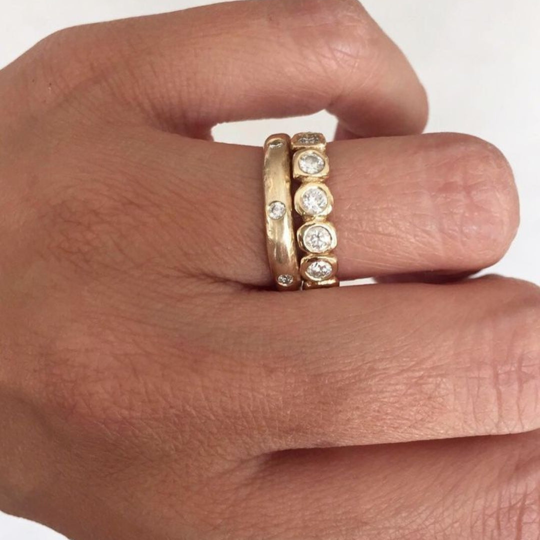 Zirconia inlaid ring set